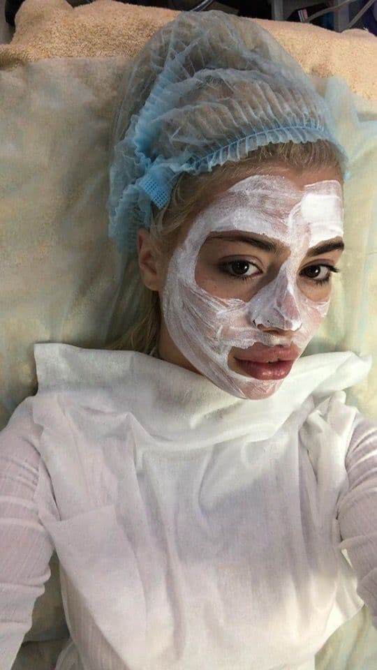 HOFMANNITA грудь