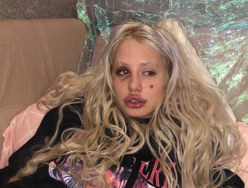 HOFMANNITA соски