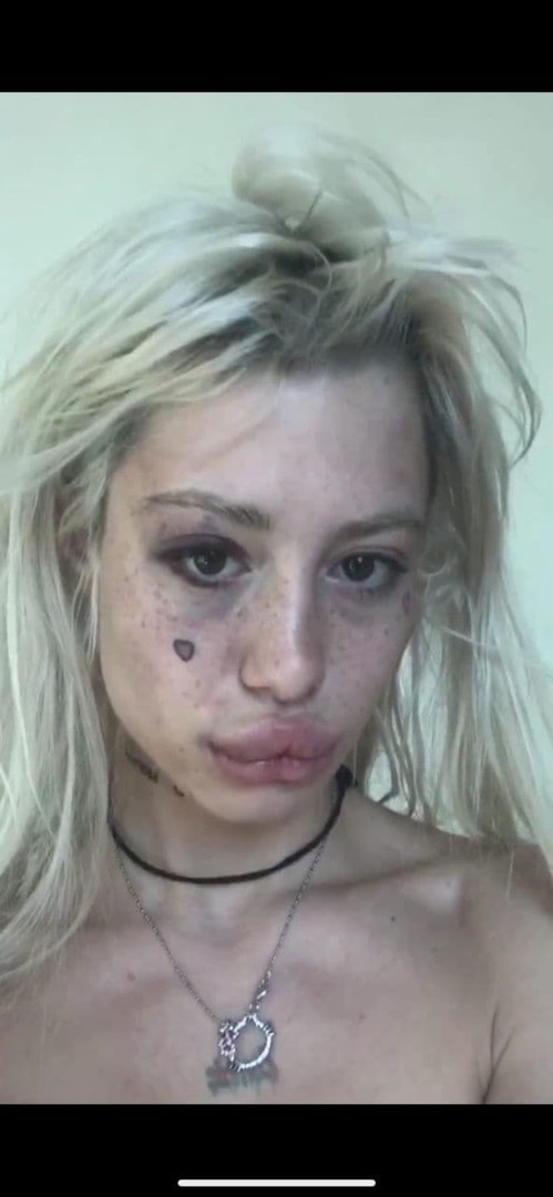 HOFMANNITA просвет